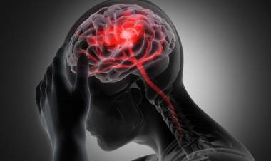 Salud informa los factores para reconocer a tiempo un ACV