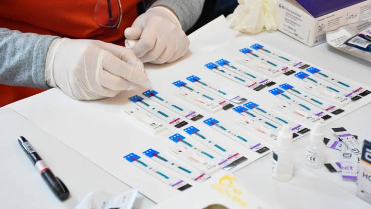 Salud informan los lugares donde realizan testeos gratuitos de Hepatitis