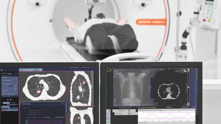 El Hospital Marcial Quiroga lanzó un programa gratuito de detección temprana de cáncer de pulmón